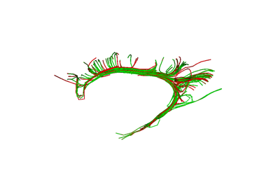 BUAN Bundle Shape Similarity Score