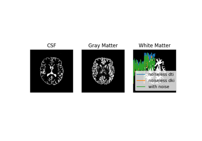 DKI MultiTensor Simulation