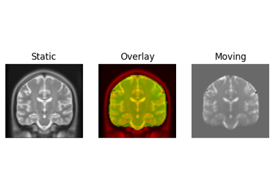 Applying image-based deformations to streamlines