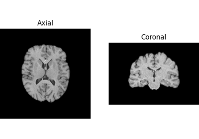 Tissue Classification of a T1-weighted Structural Image