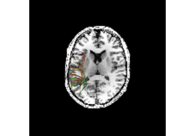 Tracking with the Sparse Fascicle Model